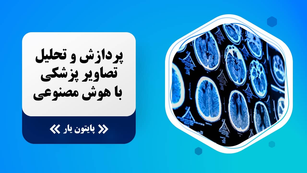 پردازش و تحلیل تصاویر پزشکی با هوش مصنوعی